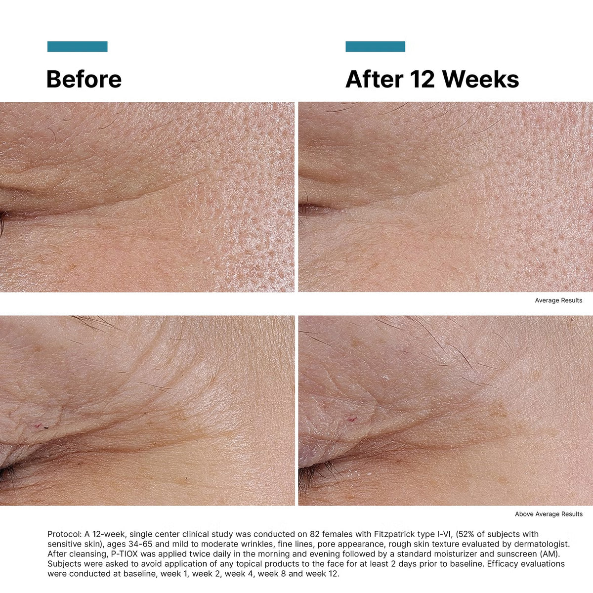 P-Tiox Serum